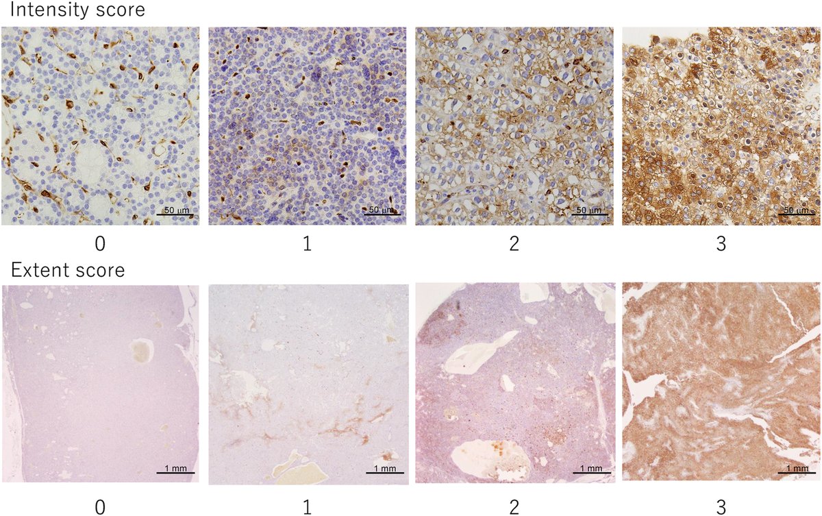 Human Pathology tweet media
