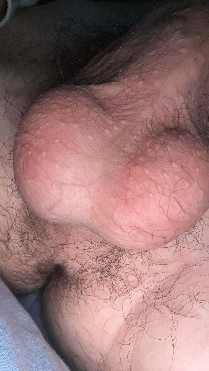 xx_HUGO_xx tweet media