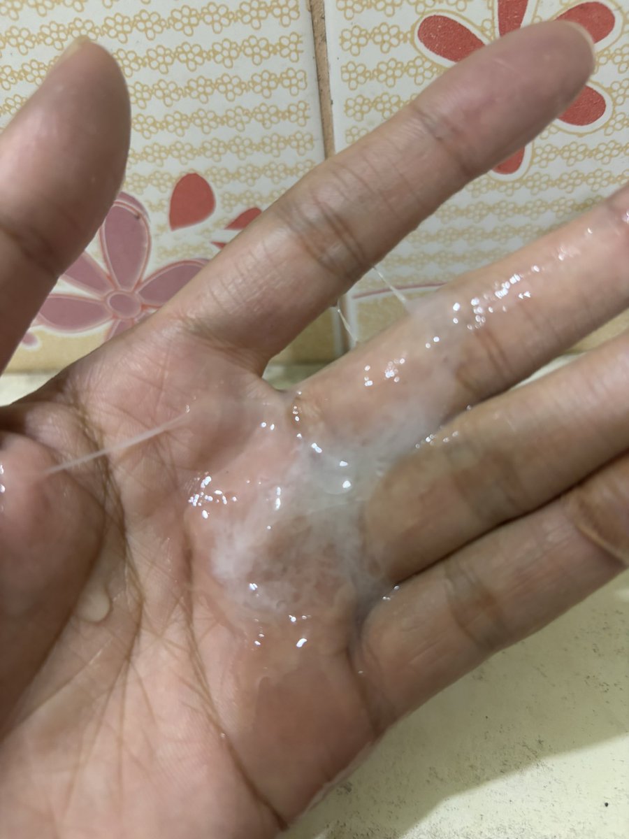 ช่วงนี้เป็นหวัด นํ้ามูกไหลเยอะมากเลย🥲🤧💦💦