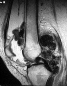 Jesse Morse, M.D. tweet media