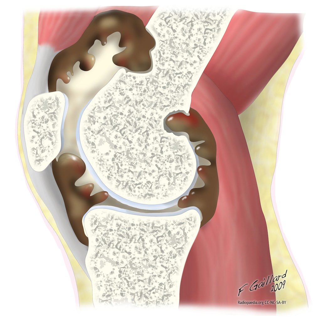 Jesse Morse, M.D. tweet media