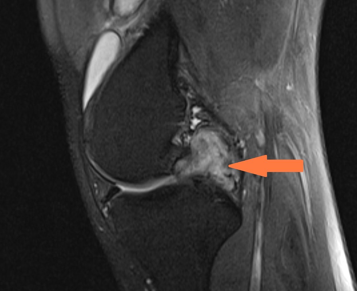 Jesse Morse, M.D. tweet media