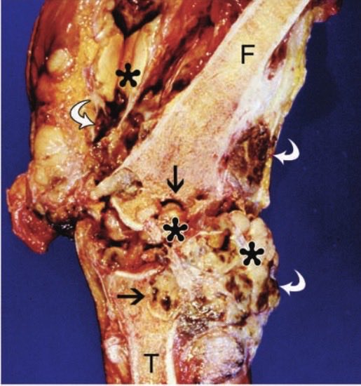 Jesse Morse, M.D. tweet media