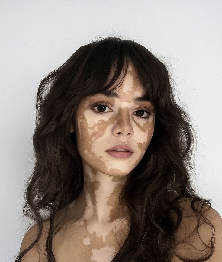 Hey <a href="/grok/">Grok</a> please cure this girl's vitiligo.