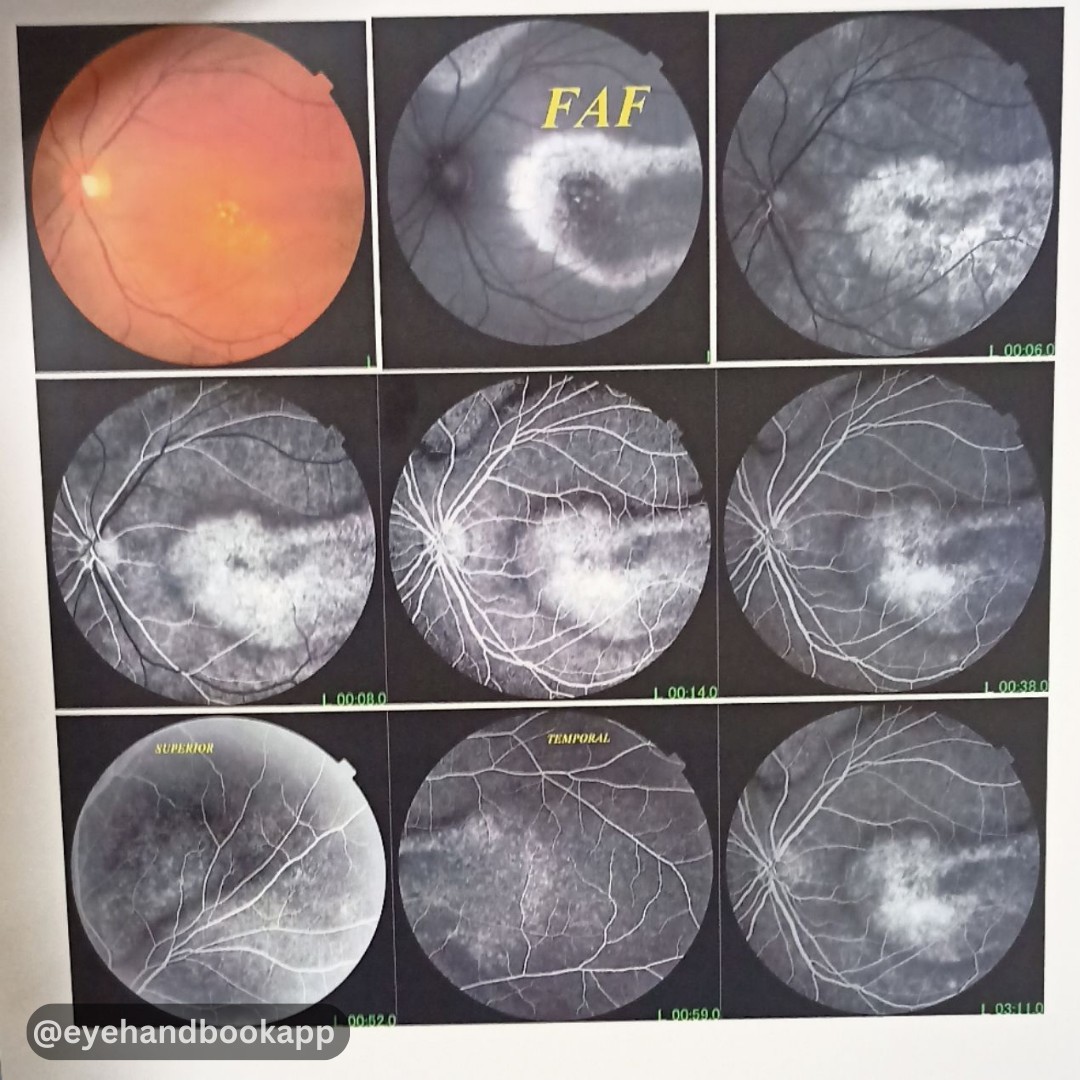 Eye Handbook tweet media