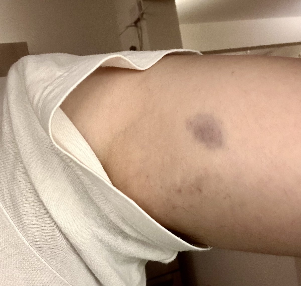 Valmiki Naik 🇮🇳 tweet media