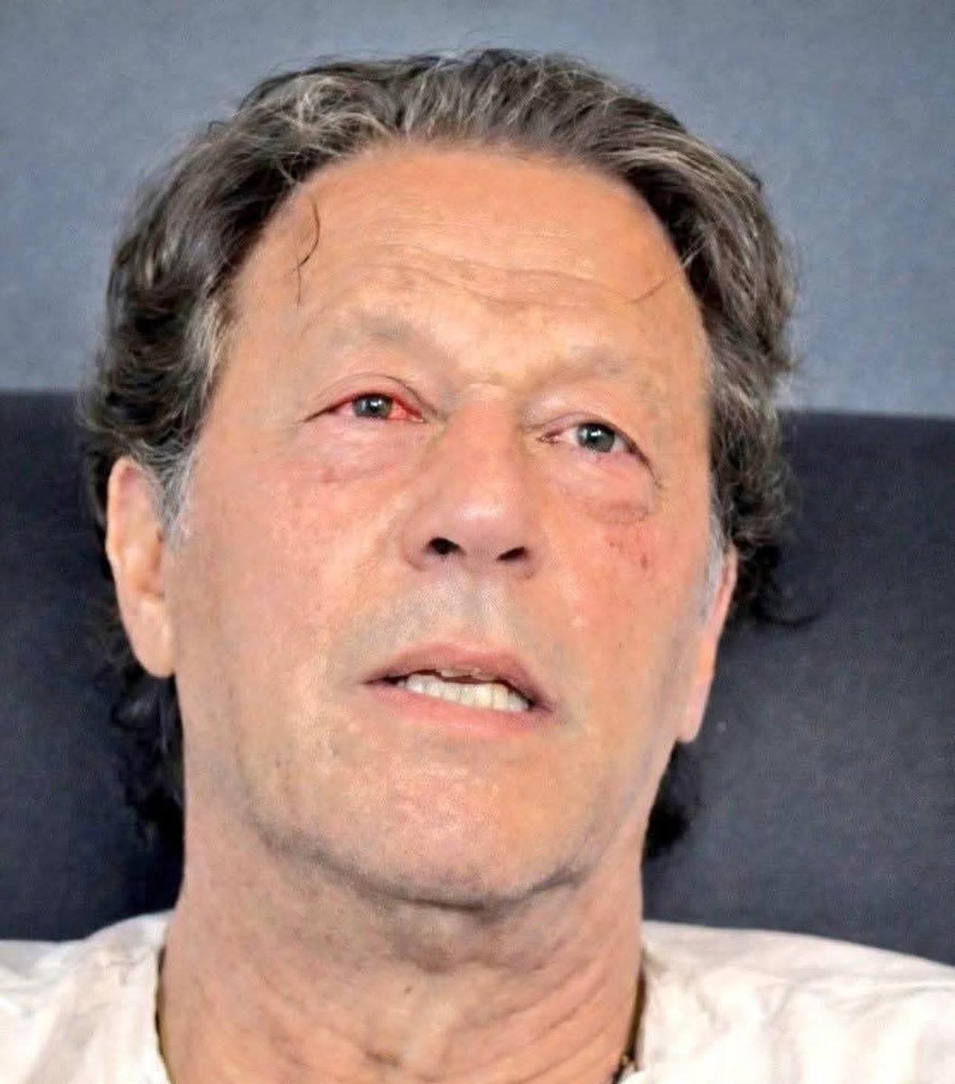 itsBadri001's tweet photo. یہ عمران خان کی انکھوں کی بینائی نہیں گئی بلکہ یہ قوم کی انکھوں کی بینائی چھینی گئی ہے 💔
#انکھ_کا_حساب_انکھ_سے https://t.co/s9XCXY29Zj