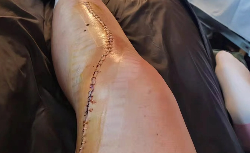 Stéphane Kohler tweet media