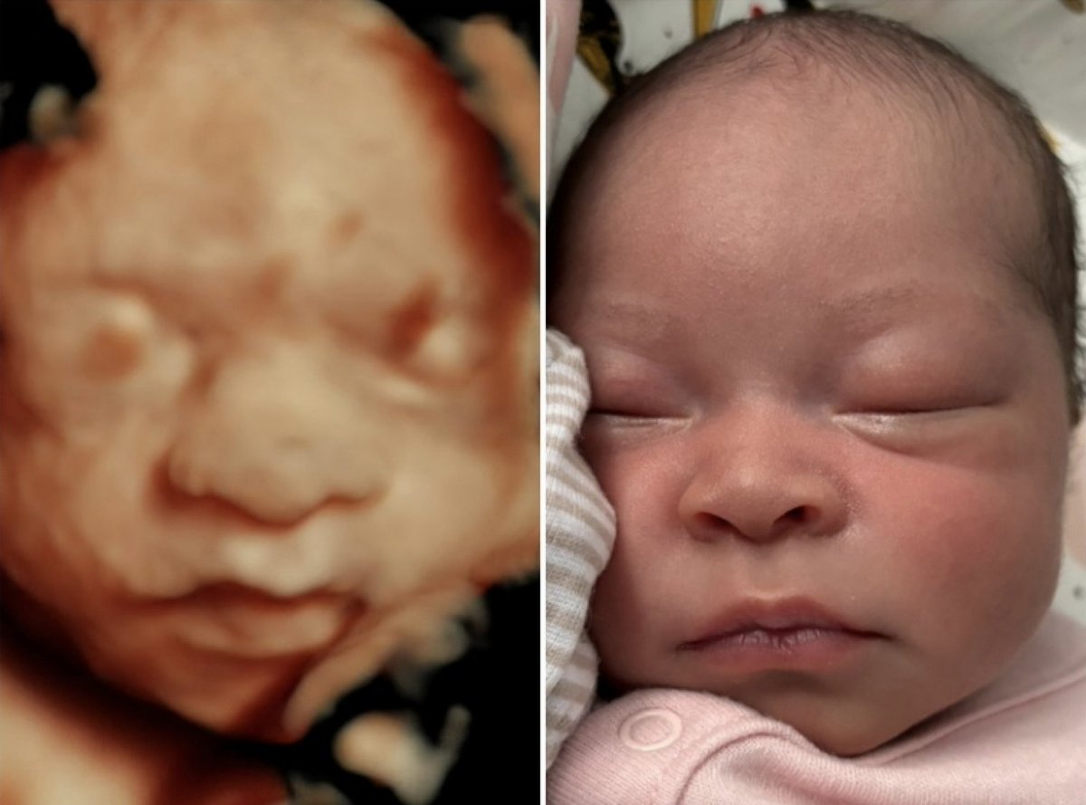 KristanHawkins's tweet image. Made in the image of God. 

 Abortion is evil!