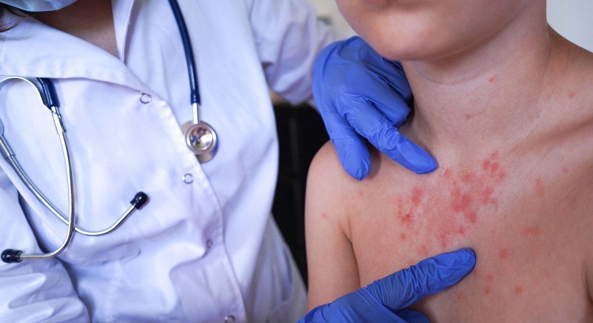 No hay cubrebocas ni gel en los hospitales d <a href="/SSDurango/">Secretaría de Salud</a> para el personal médico para  prevenir contagios de Sarampión pero <a href="/EVillegasV/">Esteban Villegas V.</a> haciendo escuelas para el ego y dándole consejos d salud a <a href="/Claudiashein/">Claudia Sheinbaum Pardo</a> asi la salud en Durango <a href="/AntonioBrachoM/">Antonio Bracho 🇲🇽</a> <a href="/contralor2018/">Contralor Ciudadano.</a> <a href="/SSalud_mx/">SALUD México</a> <a href="/CTDGO/">ITS' CTD🤘</a>