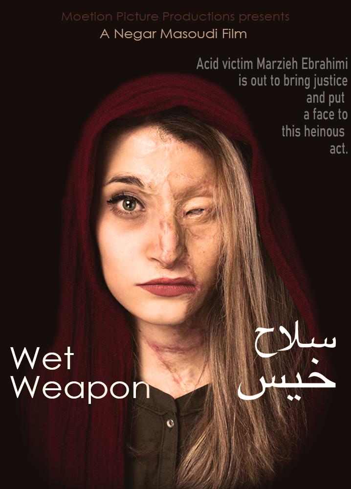 They poured acid on Marzieh Ebrahimi’s face for the "crime" of showing her hair. If you think this is an isolated incident, you aren’t paying attention. This is the calculated reality of life under the Islamic Republic—a regime that views women as property and Sharia as the