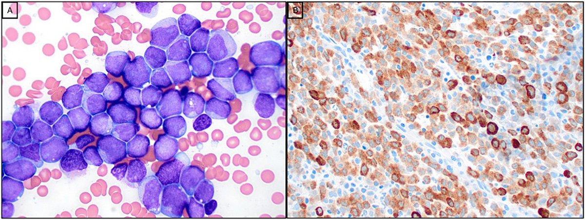 Human Pathology tweet media
