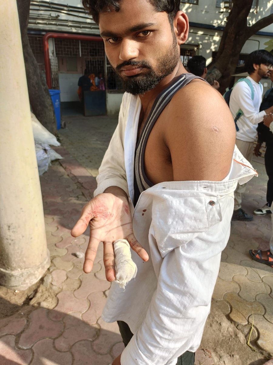 nsui's tweet photo. NSUI strongly condemns the brutal assault on Chhatra Parishad’s Murshidabad University Unit President Sabuj Sarkar and fellow activists by TMCP goons. This cowardly attack exposes the growing intolerance towards democratic student voices. Universities must remain spaces of debate, not intimidation. Those responsible must be held accountable immediately.

NSUI stands firmly in solidarity with Sabuj Sarkar and all student activists fighting for their democratic rights.