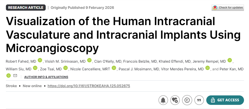 visishs's tweet photo. 📢 Proud moment: our work “Visualization of the Human Intracranial Vasculature and Intracranial Implants Using Microangioscopy” is now published in @StrokeAHA_ASA .​

Collaborators/supporters: @PeterKa80460001 @vitorpereiracan @vena_medical.

https://t.co/e49nK70D09 https://t.co/50Vyr3vAGj