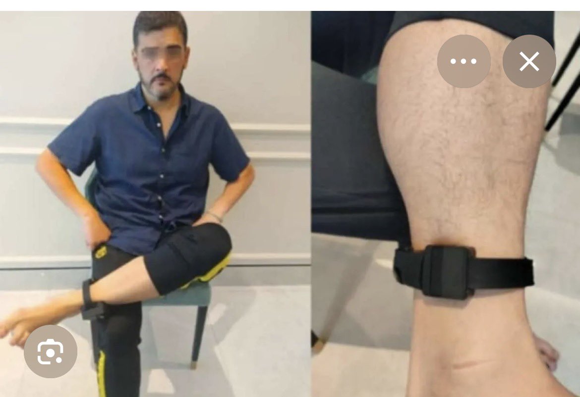 Por la imagen, se trataría de un grillete electrónico con sistema antimanipulación, diseñado para usarse de forma continua y cargarse sin retirarlo. Solo pueden ser removidos por personal autorizado, por lo que la versión de que se lo quitó “para cargarlo” no cuadra.