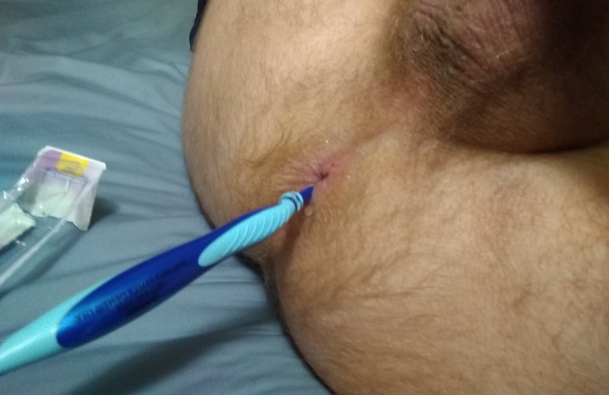 Risky Risque tweet media