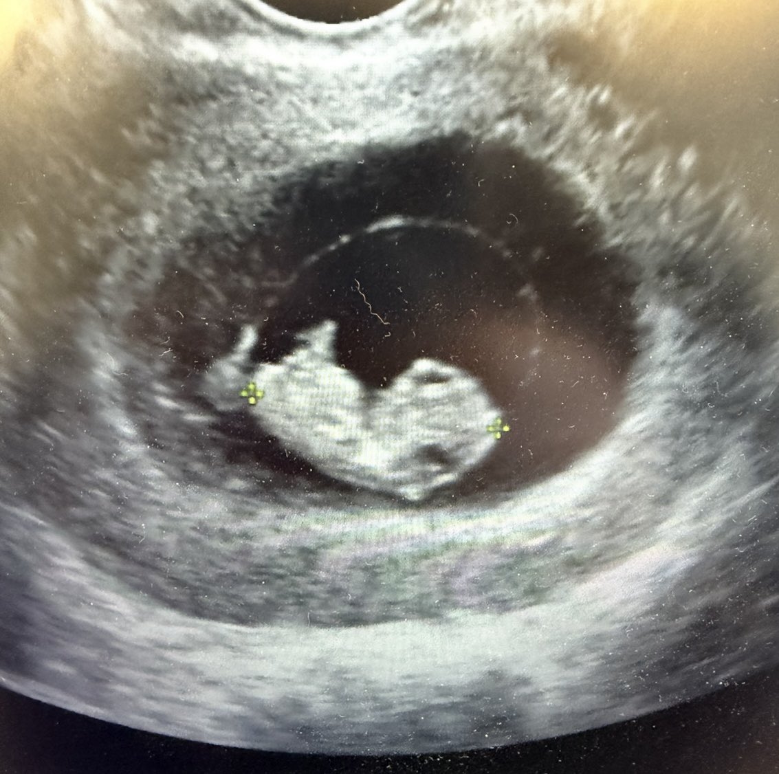 Unimpressed Ghost ❤️‍🔥🇨🇦 tweet media