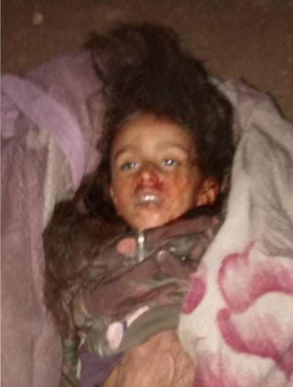 🚨 عاجل #الحسكة⚡️Breaking News️‼️

ميليشيا قسد تستهدف سيارة مدنية فيها أطفال في محيط مدينة الحسكة.

المعلومات الأولية تفيد بمقتل سيدة (هدى محمد خير) و3 أطفال وعدة إصابات.