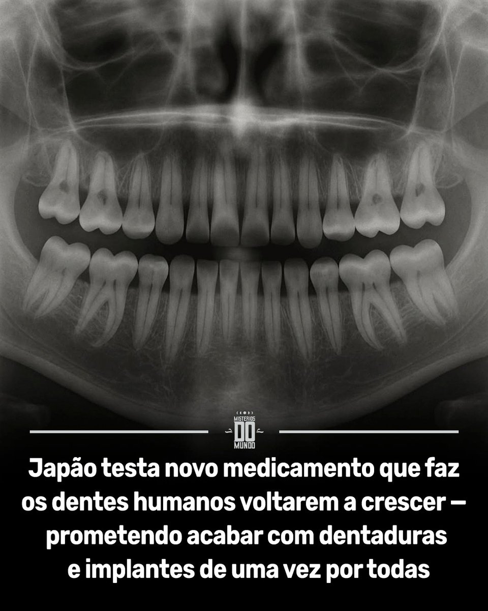 🦷 Cientistas no Japão desenvolveram um medicamento capaz de fazer os dentes humanos crescerem novamente de forma natural.

A equipe liderada pelo Dr. Katsu Takahashi, do Medical Research Institute Kitano Hospital, criou uma substância que bloqueia a proteína USAG-1, responsável