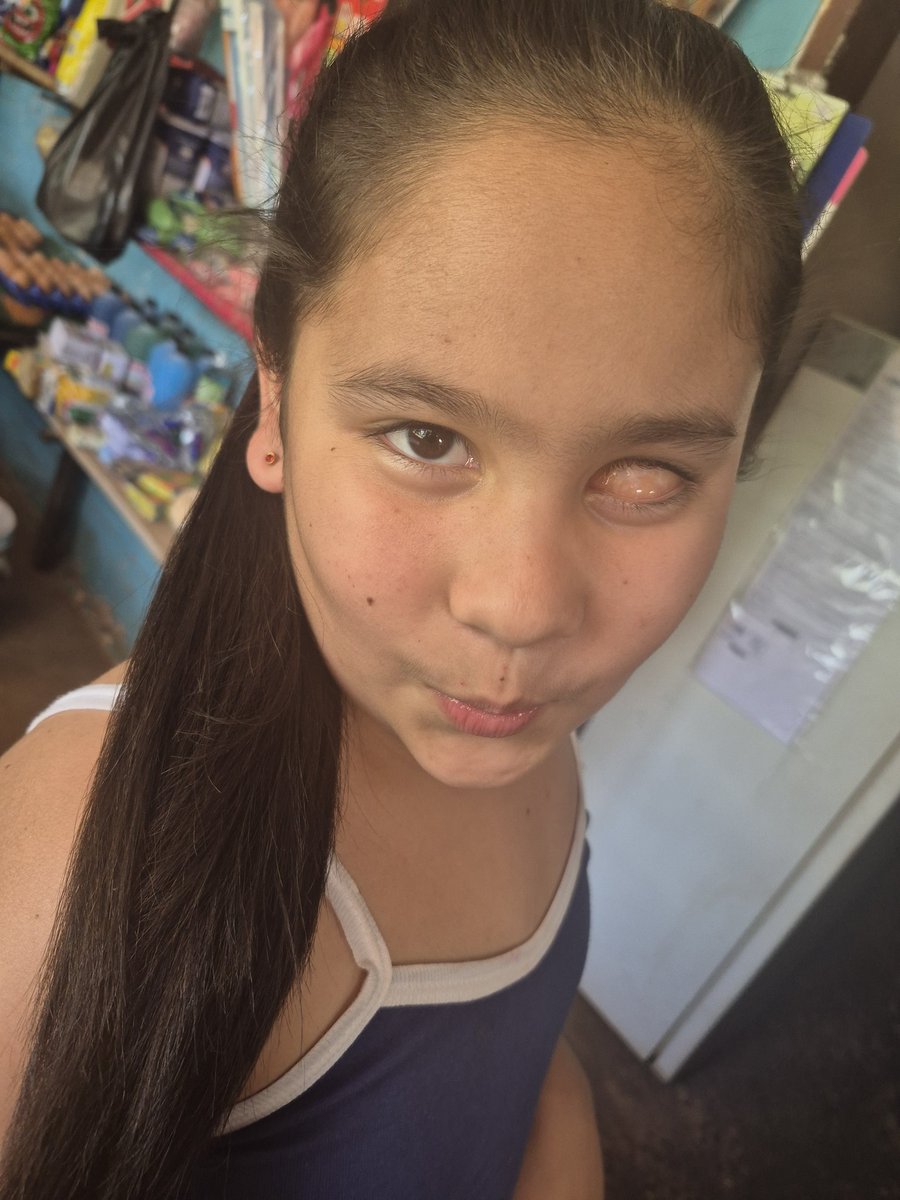 SolAracelyCant1's tweet photo. Aun tengo esperanzas esta noche😭🙏, 
Mi hija thais merece irse y que se relaize su fondo de ojo mas quimiointravitrea que necesita  si o si. Xfsvor gente una mano necesito de eust3desz desde un 2 mil estrellas juntando todo se puede 😭😭😭😭😭😭😭🙏🙏🙏🙏 https://t.co/pVna0RRbZI