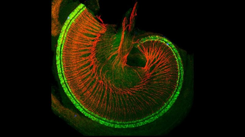 forallcurious's tweet image. 🚨: Breakthrough trial shows stem cell injections can regenerate inner-ear nerves and restore hearing