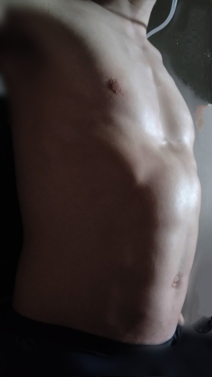 TonicInflator tweet media