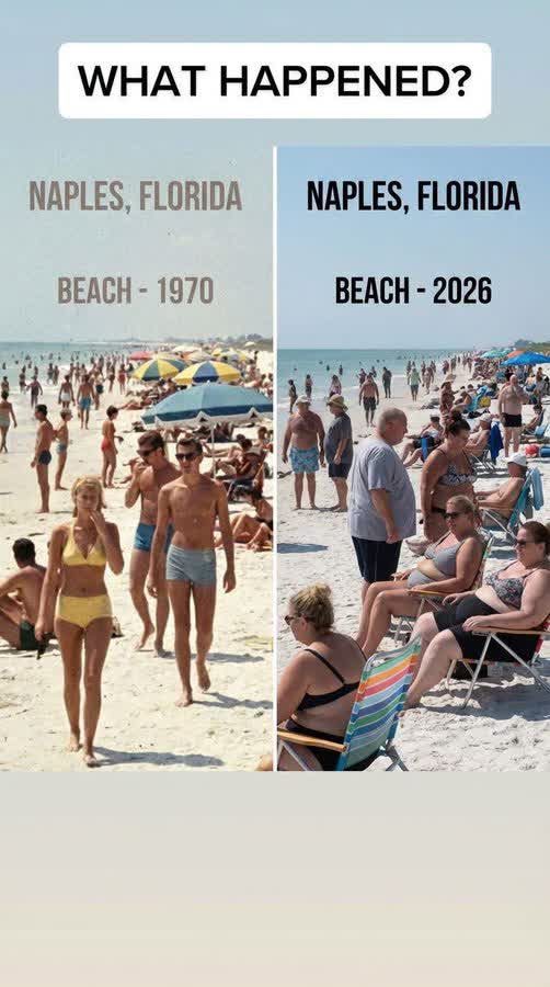 gregogallagher's tweet image. Seed oils were widely used in the 1950’s. Nor are they inherently bad.

Added sugar intake went up, but has since gone down in last 25 years🤔 

It’s literally that calorie intake has gone up by 400, and activity (step count) has gone down significantly 

More office jobs. People…