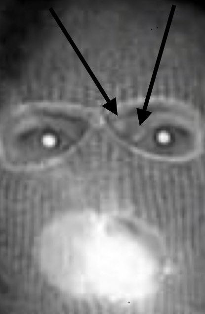 This “fat mass / fibroma”… can also be starting point for identification…besides “eye socket”….stop talking about fucking jacket…
#NancyGuthrie #NancyGuthrieKidnapping 
<a href="/NBCNews/">NBC News</a>