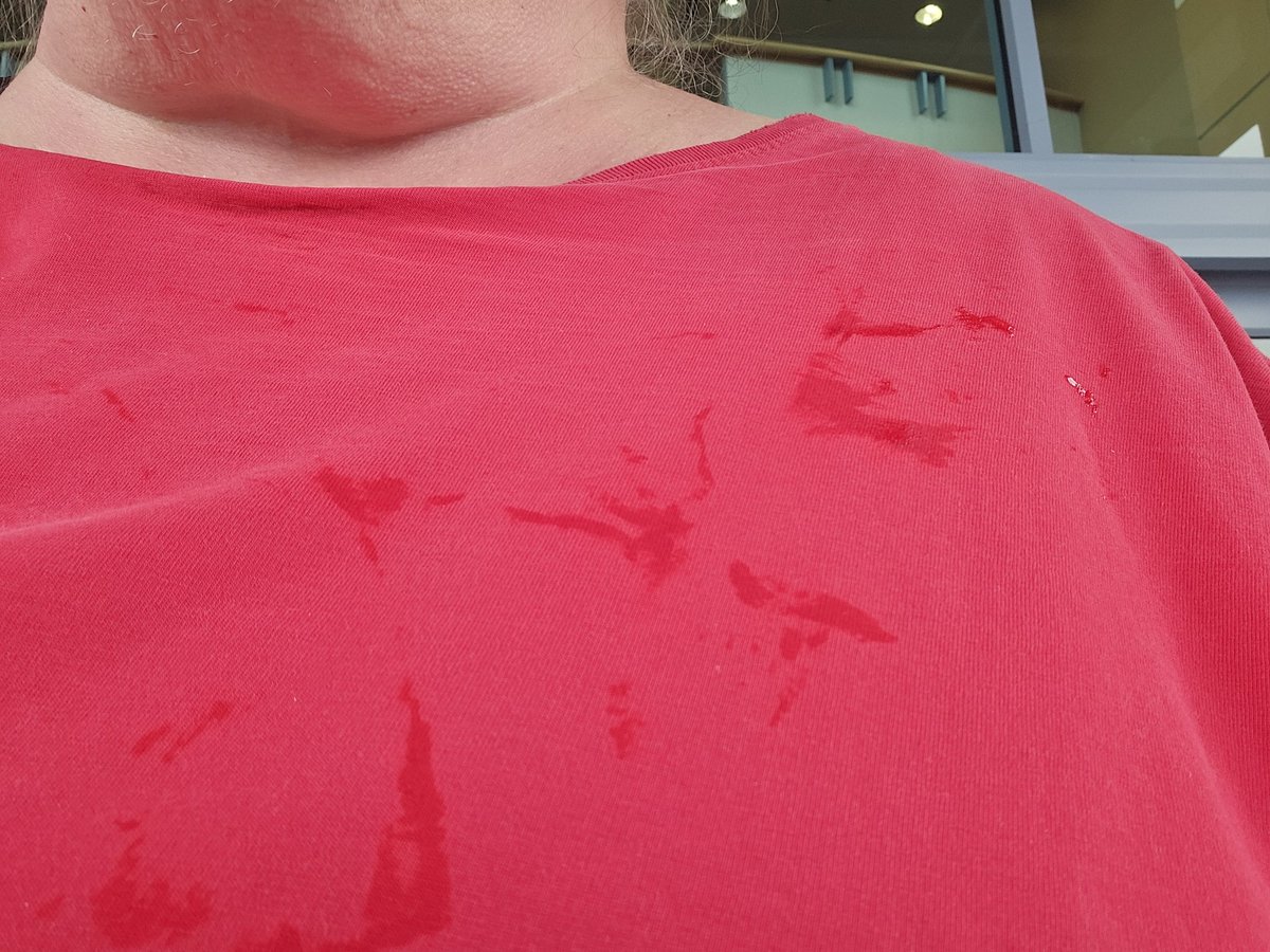 Ultrasound done, but now it looks like I drooled all over myself. Good thing I'm headed straight home.