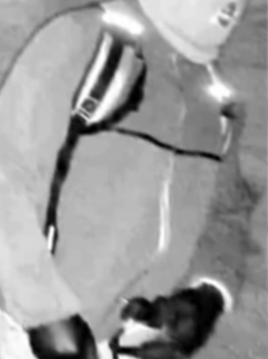 GTinvestigates's tweet photo. Take a close look at the backpack shown in the surveillance footage from Nancy Guthrie’s home.

Do these look similar?

@FBI @NBCNews https://t.co/mxnoRkNXfJ