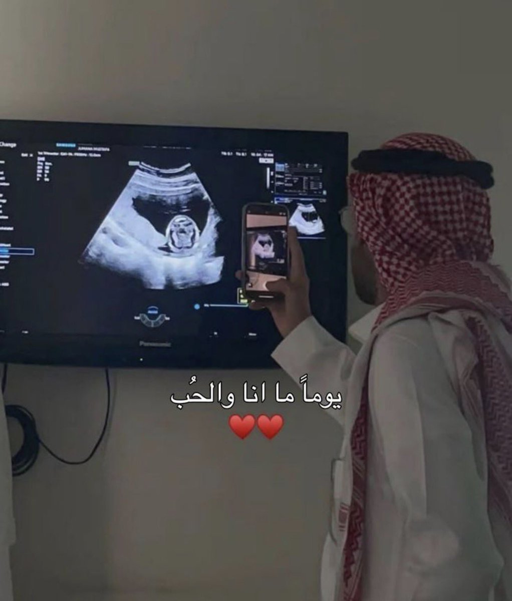 اكثر سبب يعزز رغبتك بالزواج