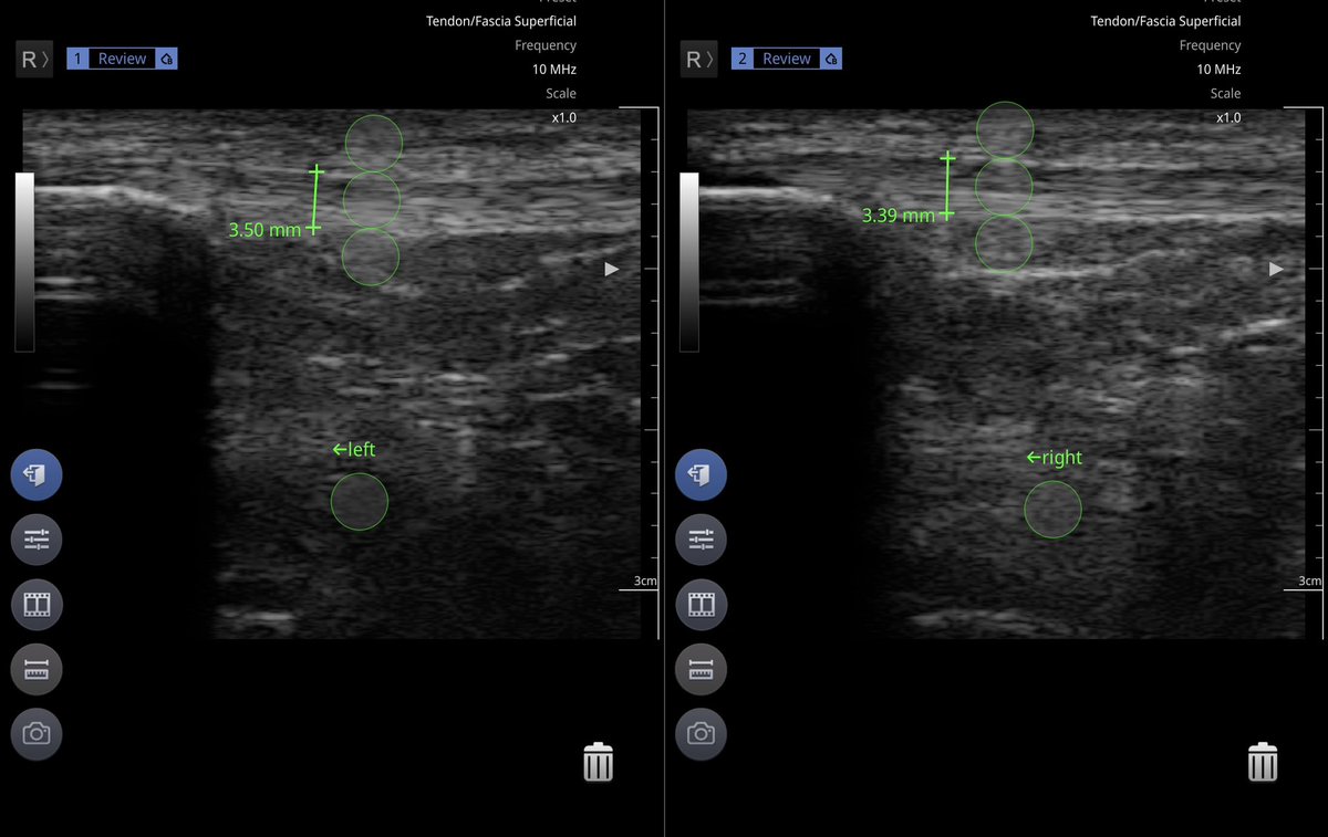 Ethan Solger M.Ed, LAT, ATC, CIDN, MDNC tweet media