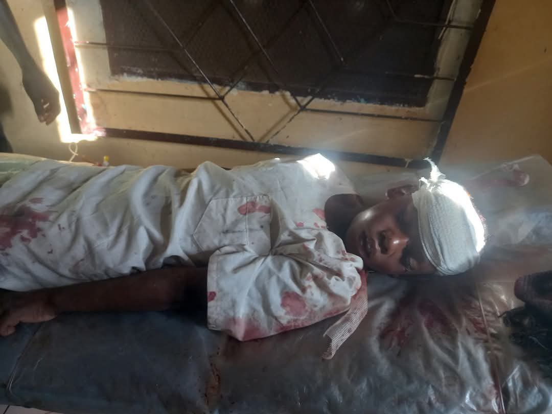 sudan_war's tweet photo. 🚨 صور للأطفال بعد استهدافهم عبر المُسيّرات: https://t.co/S5WZegMbkh