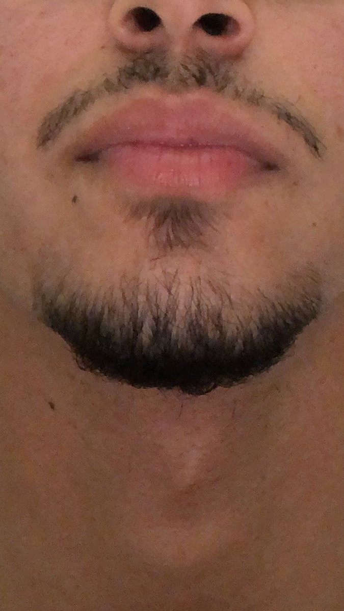 7Nono🇬🇫 tweet media