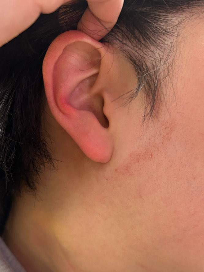 엘리베이터에 갇혀 짓밟힌 당사자입니다. 
정황이 없어 끝부분만 영상이 찍혔지만 계속해서 여러명의 보안관이 돌아가며 목과 얼굴을 짓밟았습니다. 고립된 공간에서 두 다리를 붙잡아 거꾸로 매달다시피 하며 쏟아진 발길질은 강제퇴거를 넘어 집단 린치에 가까웠습니다.