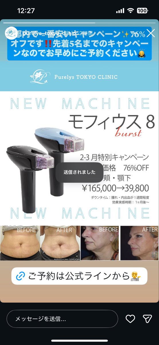 japonaiseweirdo's tweet photo. @beauty_watapico 
破格モフィウス8バースト
先着5名だからもう遅いかもだけどシェア https://t.co/2gGDrNoWrk
