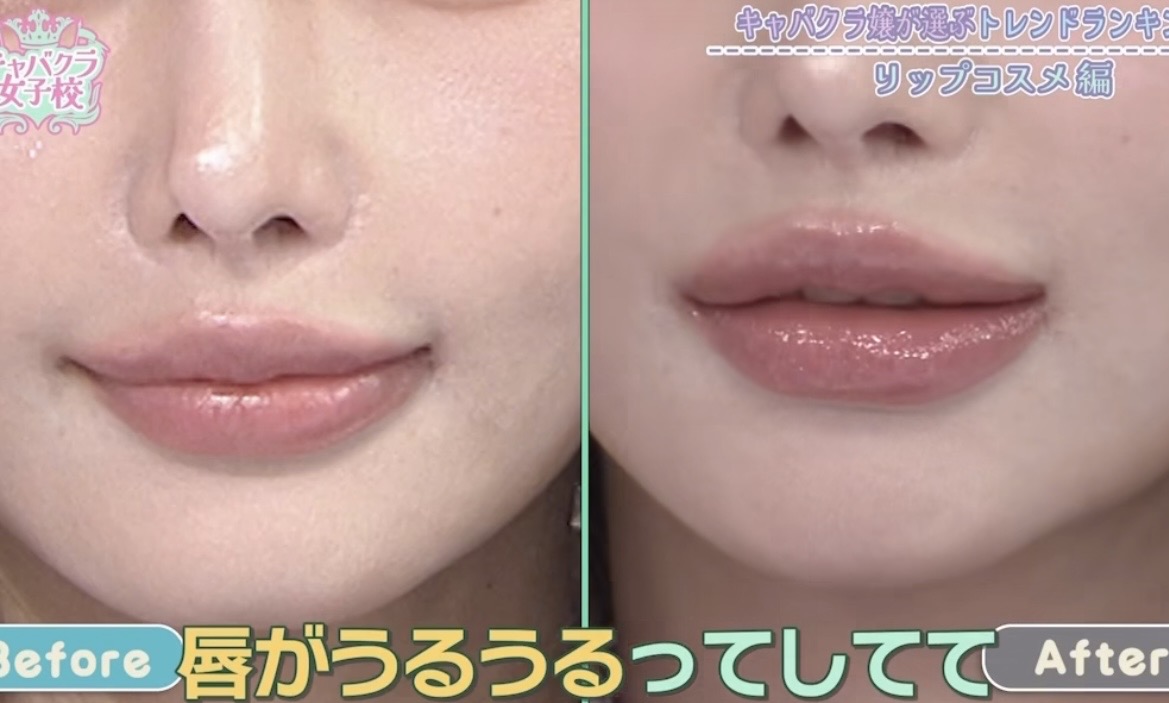 peytoncookk1's tweet image. 唇薄くてリップ塗っても盛れないタイプなんだけど、これ超ぷっくり感出て石原さとみっぽくなれる。