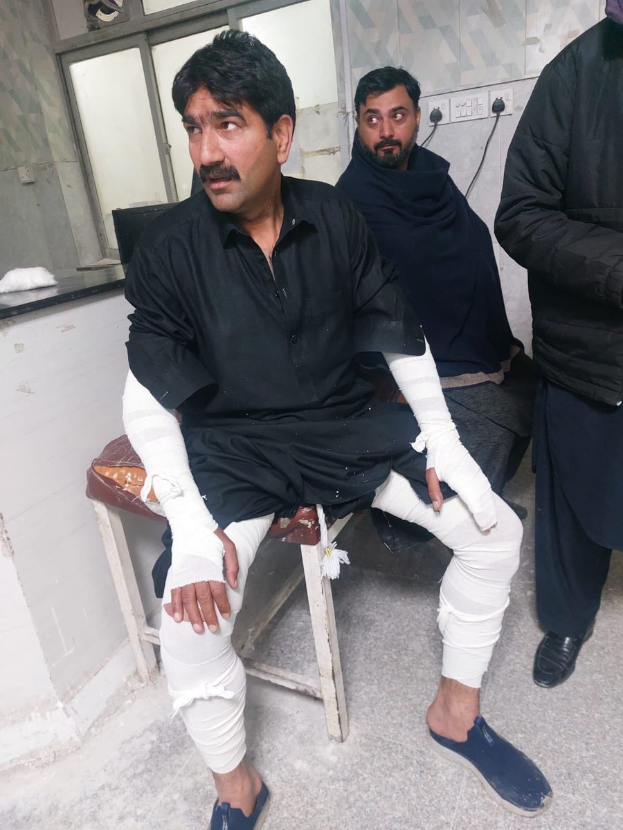 Naked fascism and cruelty. 

Ali Zaman  is an advocate of the Supreme Court, Form 45 MPA, and above all a citizen of Pakistan. His abduction in Rawalpindi last night by ‘unknown individuals’ and brutal torture serves as a stark reminder of the #AsimLaw that prevails in Pakistan