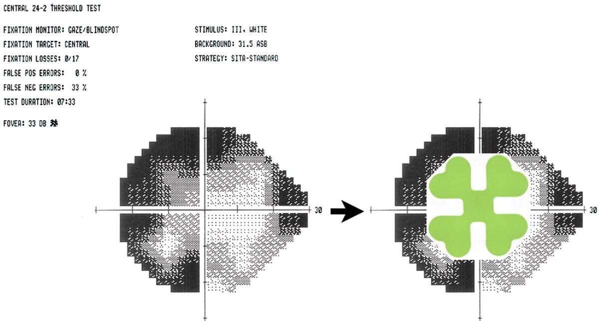 Dr Gunjan Deshpande MRCSEd, FICO (UK), FAICO, DNB tweet media