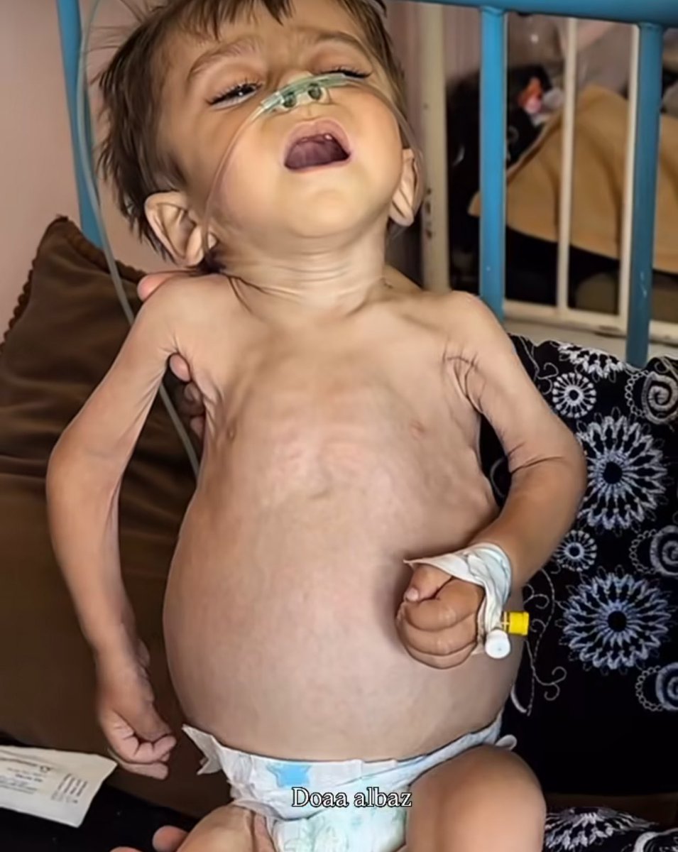 Yousef in Gaza 🇵🇸 tweet media