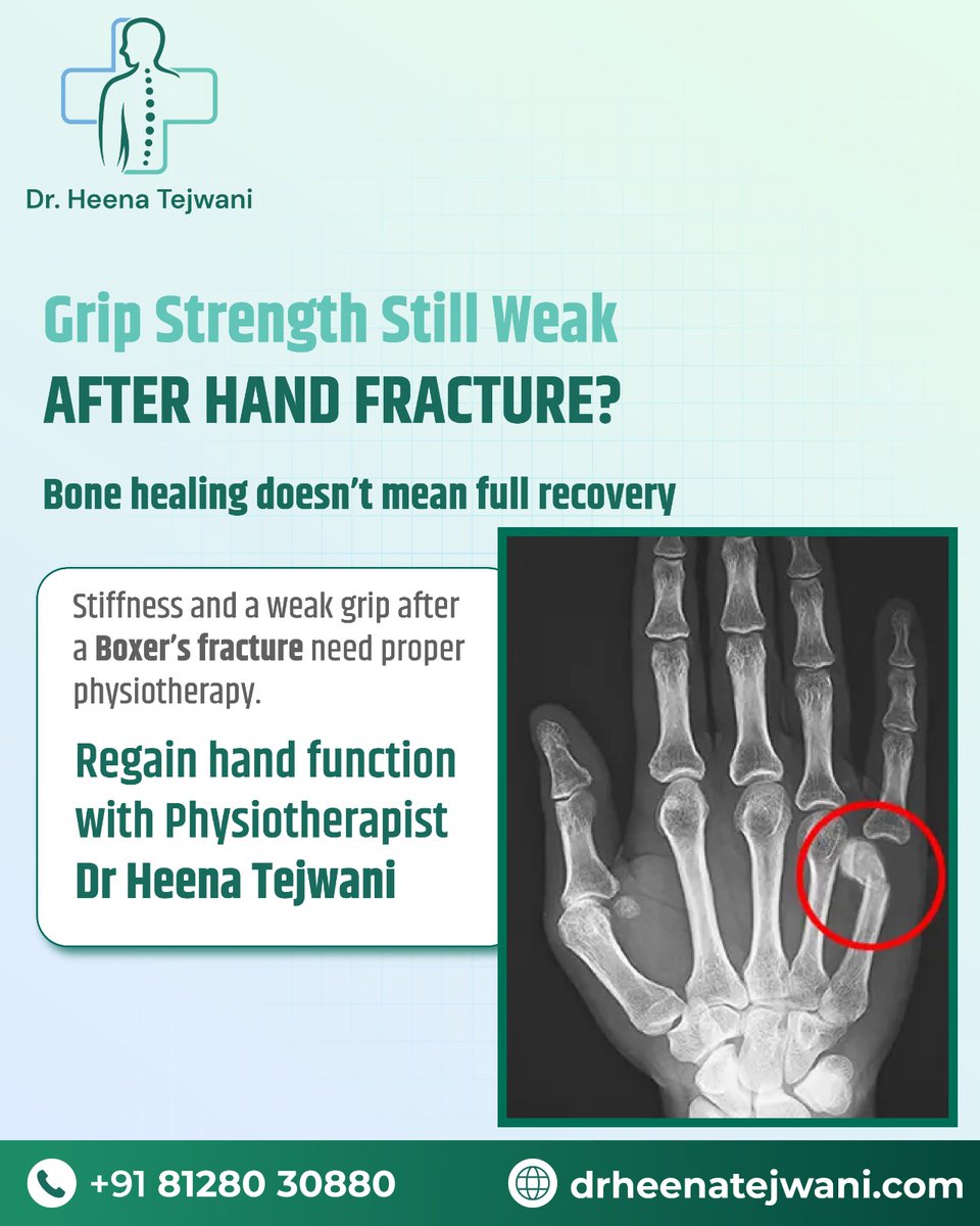 drheenatejwani's tweet image. Grip still weak after fracture? ✋

Bone may heal… but strength, mobility &amp;amp; control need rehab.

Dr. Heena Tejwani
📞 +91 81280 30880
🌐 drheenatejwani.com

#HandFracture #BoxersFracture #GripStrength #HandRehabilitation #PhysiotherapyTreatment #OrthopedicPhysio