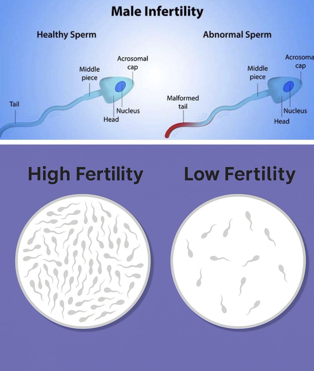 DivineManhood's tweet photo. Most men are unknowingly destroying their fertility every single day.

Here are 8 silent killers that are murdering your sperm count (&amp; how to fix them): https://t.co/uyVnTe6vEm