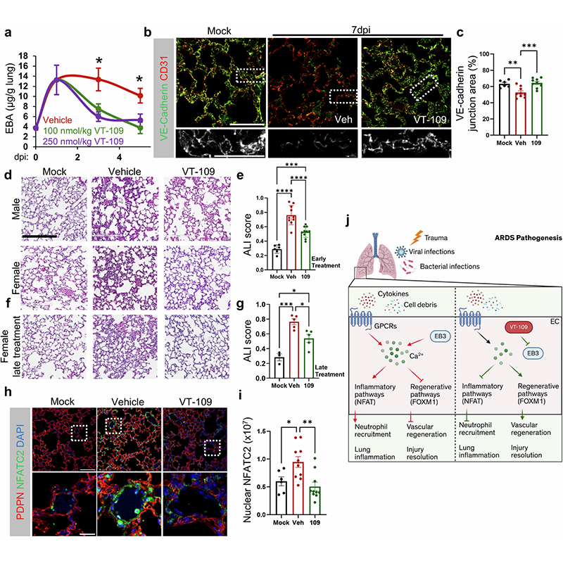 sigtrans_sttt's tweet photo. VT-109, an EB3 inhibitor, restores endothelial integrity in #ARDS by blocking #CalciumSignaling, reannealing VE-cadherin, and activating #FOXM1; it improves #LungFunction and reduces #inflammation. @thisisUIC 

#OpenAccess in #STTT: https://t.co/ZWZSlAHV8Y https://t.co/a4lt0w8qu9