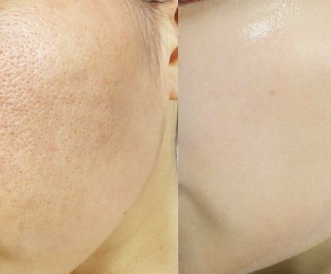 mimisaidi tweet media