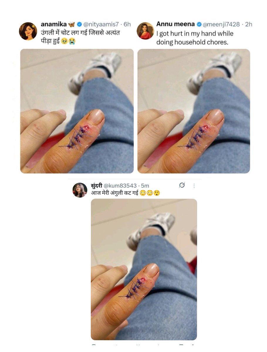 एक ही उंगली में 3 लोगो को सेम एंगल में कट हुआ है बहुत ही दुःख हो रहा है ।😭😅😅

बहुत ही गिरा हुआ उंगली हैं यार 😭😅🥺