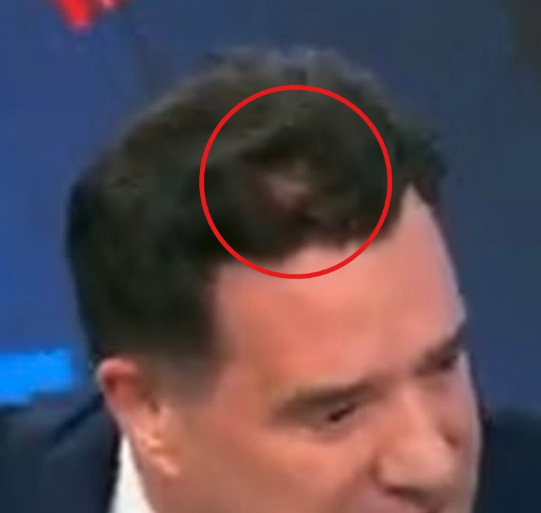 Επεσε ο σπόρος σε μπλανα κ δεν έπιασε .