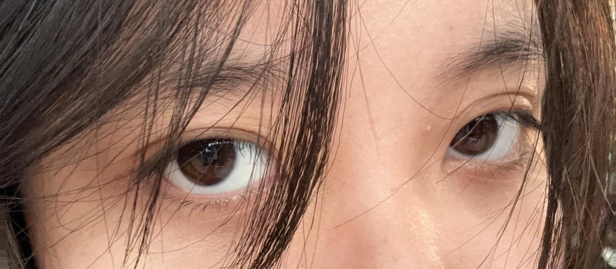 Cry more someone will donate enough money for you to do eyelid surgery