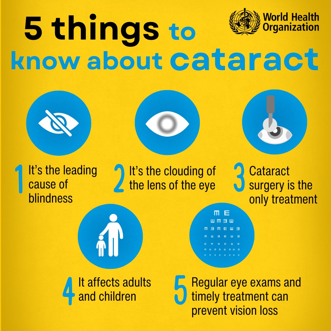 Cataract is the leading cause of blindness worldwide. Yet it’s also one of the most treatable.

- Knowing the signs
- Getting regular eye exams
- Accessing timely treatment

can protect your 👁️ vision.

Here are 5 things to know about cataract 🔗 bit.ly/4bNNEGU