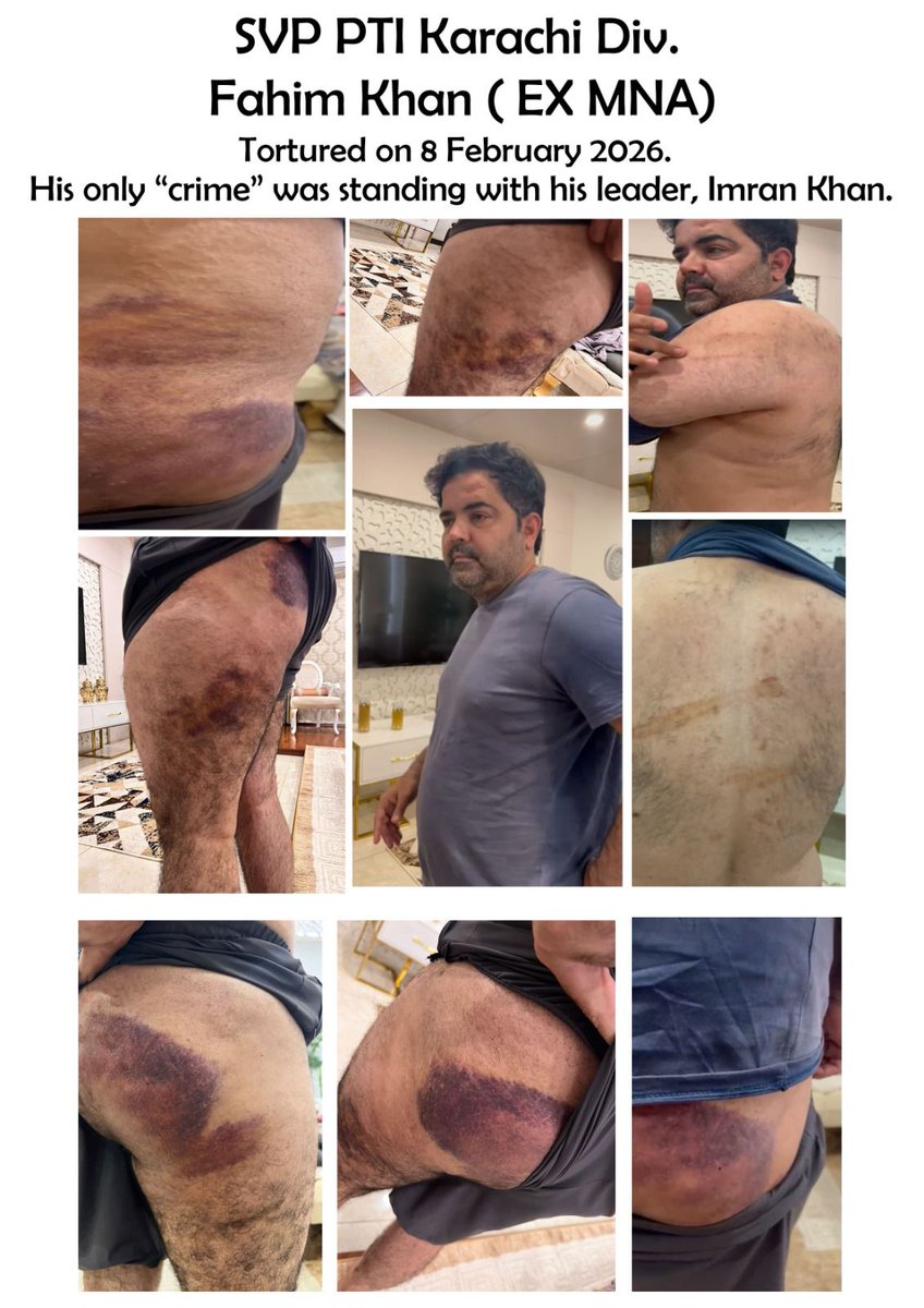 ایکس ایم این اے فہیم خان جو حقیقی آزادی تحریک اور عمران خان کا ایک تگڑا کھلاڑی ہے 
ان پر جبر فسطائیت کی آخیر کردی