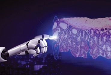 gastroendonews's tweet image. AI during colonoscopy: helpful assistant or work in progress?
New evidence shows gains in workflow efficiency—but more refinement is needed for lesion characterization. gastroendonews.com/a/IzYBAA/t #colonoscopy #endoscopy
